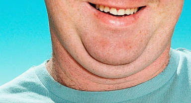 Erkeklerde yeni moda gıdı estetği